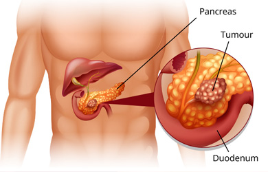Best GI Surgeon in Delhi Best GI Surgeon in Delhi